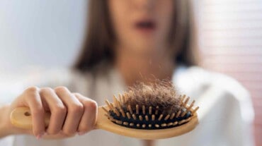 A woman before using collagen for hair growth