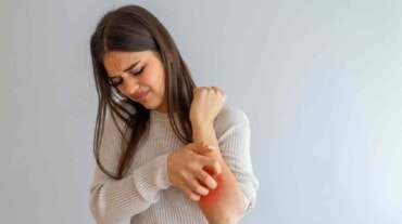 A woman scratching due to atopic dermatitis or contact dermatitis