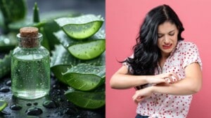 Aloe vera: 7 ways to use this home remedy to get rid of skin rashes