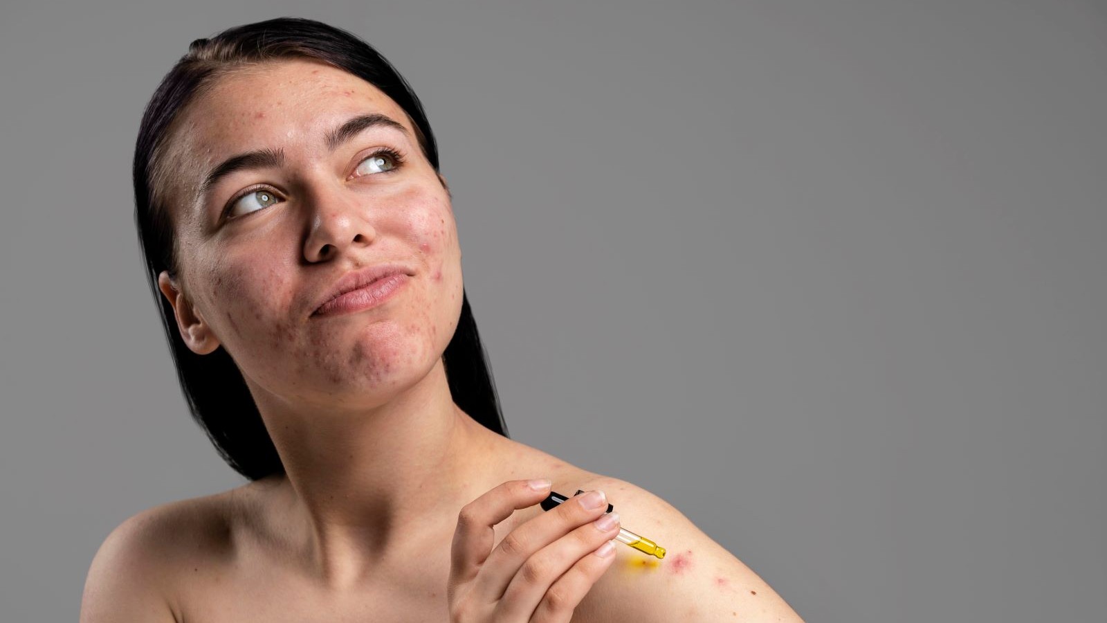 A woman with red spots on her skin